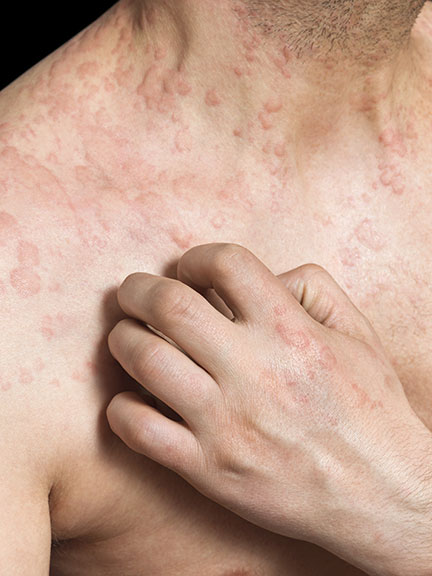 fassy Patois Dictionary